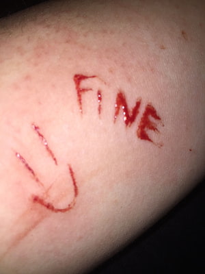 Close-up of self-harm scarification on skin with the word fine written in blood HD phone wallpaper