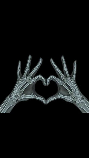 Skeletal Hands Forming Heart Shape in Dark Grunge Aesthetic Style HD phone wallpaper